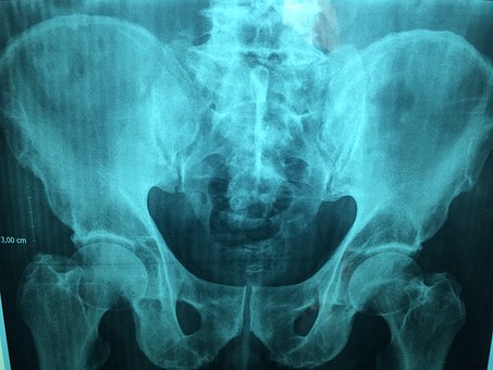Prostate Cancer - Germany Drug Forecasts and Treatment Analysis to 2020